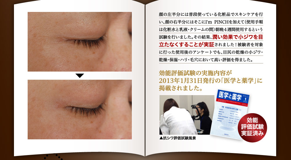 顔の左半分には普段使っている化粧品でスキンケアを行い、顔の右半分にはそこにI'm PINCHを加えて（使用手順は化粧水と乳液・クリームの間）朝晩４週間使用するという試験を行いました。その結果、潤い効果で小ジワを目立たなくすることが実証されました！被験者を対象に行った使用後のアンケートでも、目尻の乾燥の小ジワ・乾燥・保湿・ハリ・毛穴において高い評価を得ました。
　
効能評価試験の実施内容が
2013年1月31日発行の「医学と薬学」に
掲載されました。